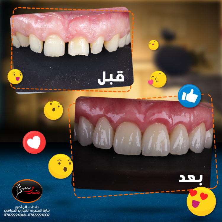 ابتسامة المشاهير